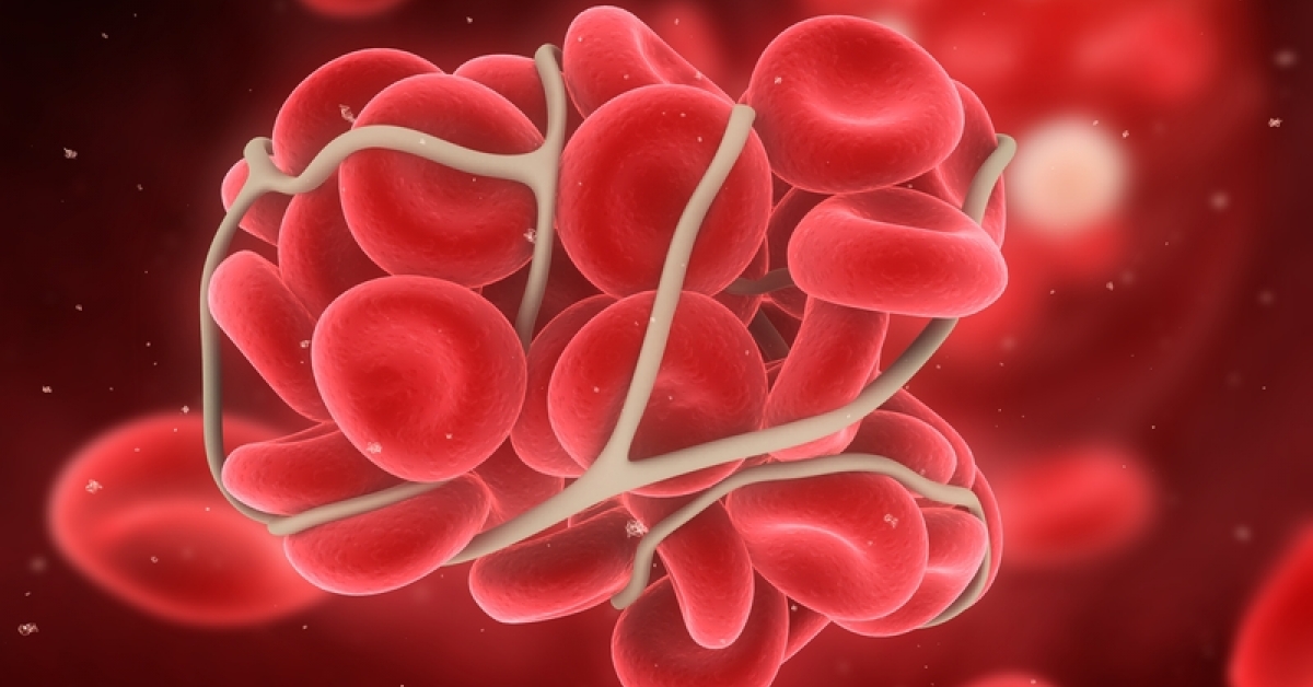 Testosterone, Blood Clots and Time
