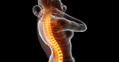 Spinal Cord Stimulation Therapy