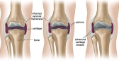 Anatomy of the Joints
