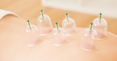 Cupping: To Do or Not to Do?