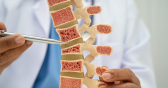 Osteoporosis and Bone Health: What You Should Know