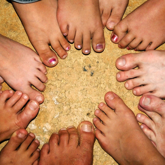 If Your Feet Could Talk Clubbed Toes Rxwiki